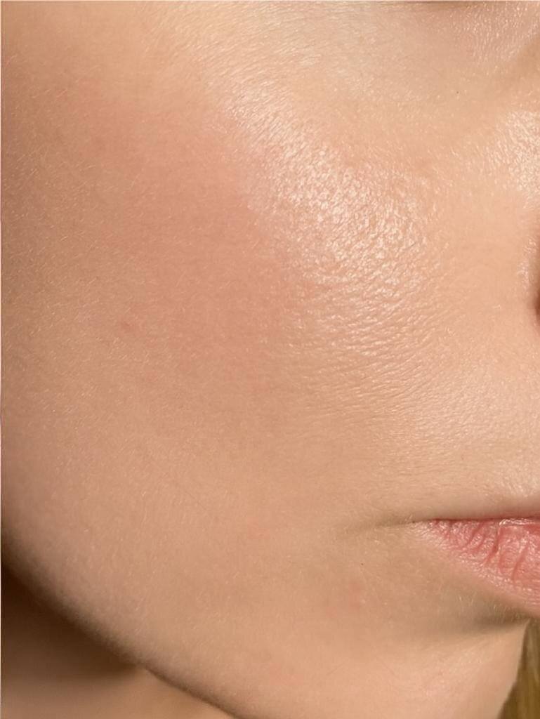 Close-up of a person's face with a focus on skin texture and color.