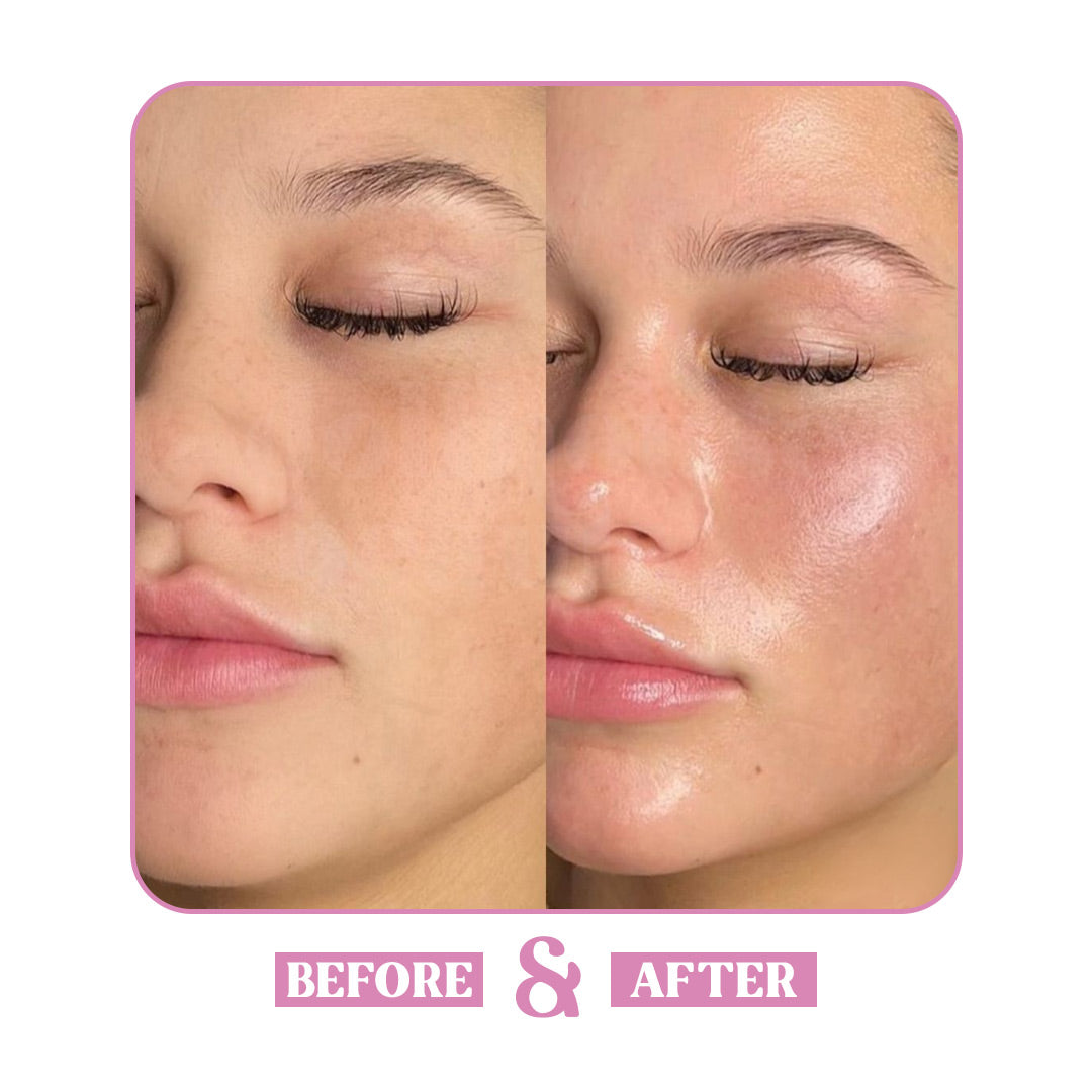 Hyaluronic Acid Serum - Lumina Care 30ml | Deep Hydration & Moisture Boost